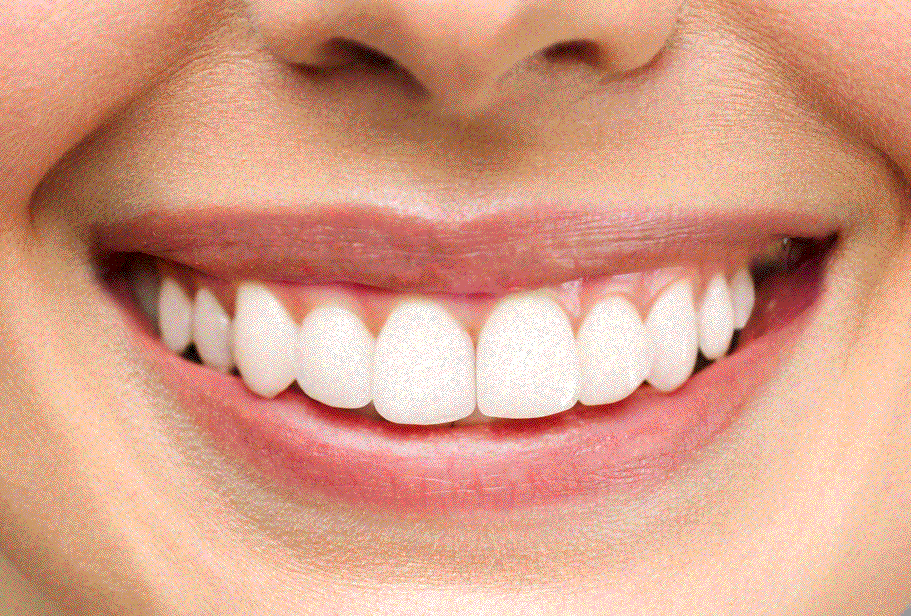 dientes-apolonia-despues-chica