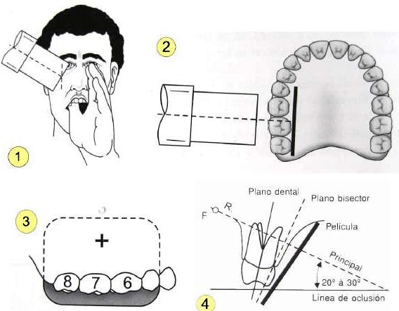 Aprende de los Rayos X Dentales: una breve guía image 3 Aprende de los Rayos X Dentales: una breve guía